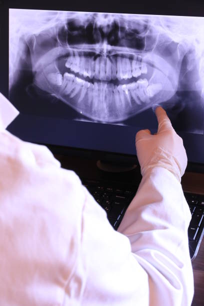 Best Emergency Root Canal Treatment in Milwaukee, WI